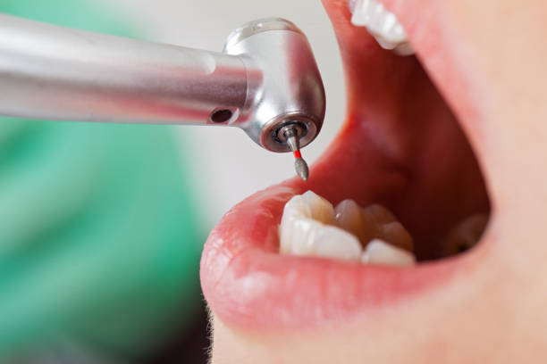 Best Emergency Treatment for Toothache in Urbana, OH